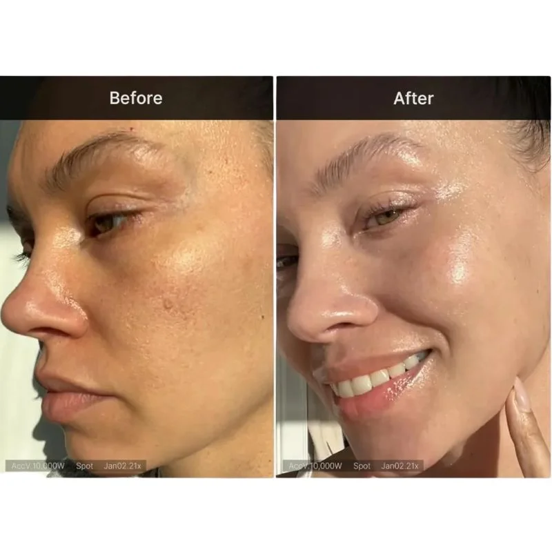 medicube deep vita c capsule cream | brightening vitamin c moisturizer